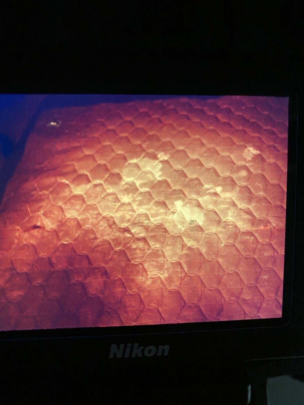 Sexual Assault Invest